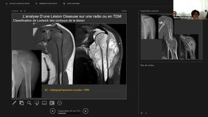 DFASM1 - BEST OF IMAGERIE EN RHUMATOLOGIE - Pr Catherine Cyteval - 07/05/2026