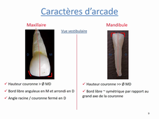 Morphologie dentaire : les incisives