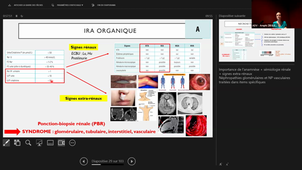 NEPHROLOGIE_21-05-2024