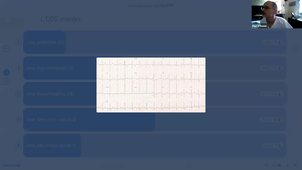 DFASM2 MIF (10/11/2020)FESLER P. Hypertension artérielle pulmonaire de l'adulte