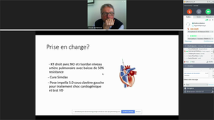 D.U Insuffisance Cardiaque Dr N ZEROUAL