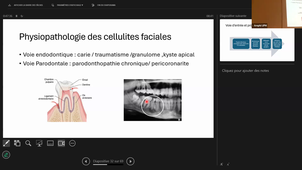 DFASM - BEST OF CMF - Dr Marie de Boutray - 03/03/2026