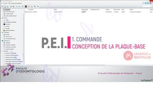 2025_3SHAPE2025_PEI_01_commande & tracé.mp4