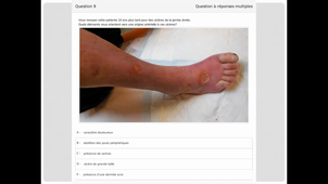 DFASM2 CONF 19/01/2021	18:30	20:30	Conférence Dermatologie 2	SCHWOB Emilie	TD 309	DFASM2