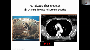 01-09-26-DFGSM3-Appareil cardio-M Prduhomme-CM01.mp4