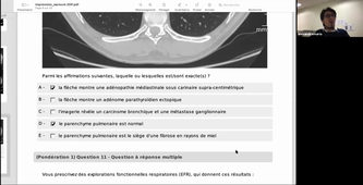 DFASM2 CONF 08/04/2021	18:30	20:30	Conférence DFASM2 Médecine interne	Maria Alexandre	Amphi UPM   DFASM2