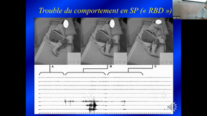 DU Médecine gériatrique, gérontologie et coordination d'EHPAD - 7ème séminaire du 13 mai  2022