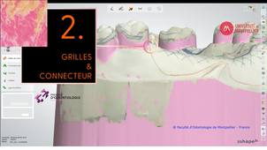 3SHAPE2025_PPAM MX 02 rétention & connecteur.mp4