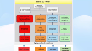 DES échographie thyroïde.mp4