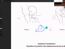 17-10-23-DFGSM2-CM6 et 8-Appareil neuro-M Bertrand.mp4