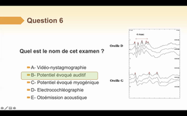 DFASM1 MID 06/11/2020 Altération de la fonction auditive. Vertige. Paralysie faciale. A-KADERBAY