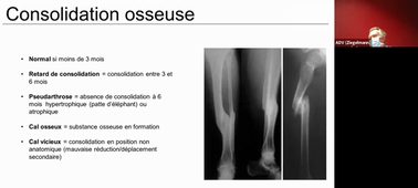 BO DFG3/DFA1 orthopédie 07/07/2021