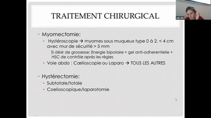 DFASM2 MIE 13/11/2020 VINCENS C. Fibromes, Endométriose