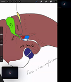 14-03-23-DFGSM2-CM7-Appareil digestif-M Prudhomme.mp4