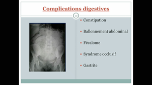DFASM2 MIF - ROUSSEL - Complications de l'immobilité et du décubitus. Prévention et prise en charge