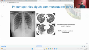 BEST OF PNEUMOLOGIE - DFASM1 - Dr Jérémy Charriot