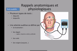 DU de chirurgie plastique pédiatrique Dr Gardini, Surveillance otologique et fente 03/12/2020