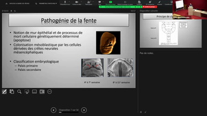 CM7 FENTE LABIOPALATINE EN SDC_CAPTIER_06-05-2024