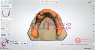2025_3SHAPE2025_PEI_02_accessoires & finalisation.mp4
