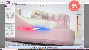 2025_MAND_K32_étape2_préparation.mp4