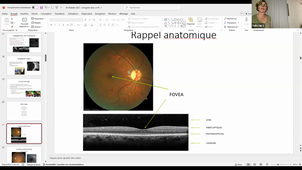 DU DIABETOLOGIE - Enregistrement vidéo n°2 - mercredi 6 novembre 2024.mp4