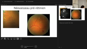 DU DIABETOLOGIE - Enregistrements vidéos - lundi 24 novembre 2025.mp4