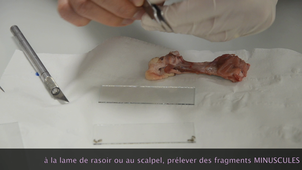 HLBE101 : protocole et observation de coupe de cartilage