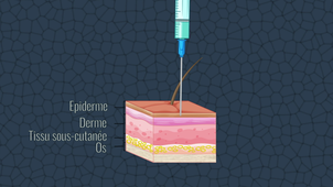2D et 3D médicale