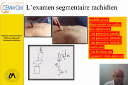 Examen segmentaire du Rachis