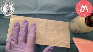 2023VB_MO MAX confection plaque base et bourrelets d'occlusion.mp4