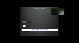 Echographie pulmonaire