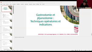 Gastrostomie et jéjunostomie_Pr BARDOL.mp4