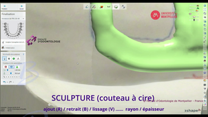 3SHAPE2025_PPAM MD 07 sculpture.mp4