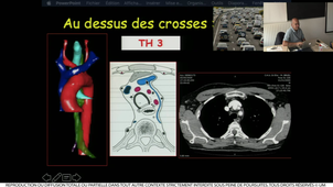 DFGSM2-A2 Prudhomme 2 Système cardio-vasculaire 041019