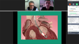 D.U Insuffisance Cardiaque Dr J ELIET
