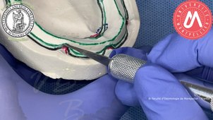 2023VB_PEI MAND contrôle des limites.mp4