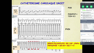 D.U Insuffisance Cardiaque Dr P BATTISTELLA