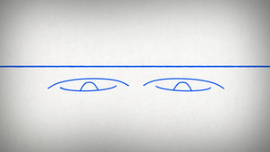 What is single crystal X-ray diffraction?