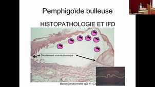 DERMATOLOGIE	Module 3	Mardi	10/01/2023	08:00	10:00	1 + 2	OLIVIER DEREURE	AMPHI RABELAIS Lien zoom : https://umontpellier-fr.zoom.us/j/3647381302	3647381302	2	OK