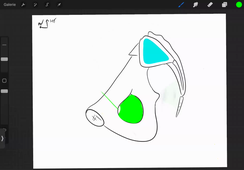 DFGSM2 UE : APPAREIL RÉNAL ET VOIES URINAIRES - CM4 Uretères et bas appareil urinaire - Pr.Duraes