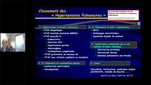 13/01/2020 (Matin) D.U Insufisance Cardiaque