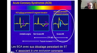 12/01/2021	14:00	16:00	DFGSM3 UE Cardiologie	F. Leclerc	Amphi Rabelais