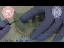 D4_M.O. mandibulaire_réalisation de la plaque base résine