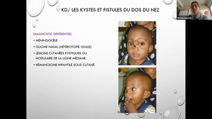 DU de chirurgie plastique pédiatrique Dr Degardin, Kystes et Fistules de la tête et du cou 08/04/2021