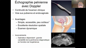 Imagerie en endocrinologie - Ovaire et testicule - Pr Taourel