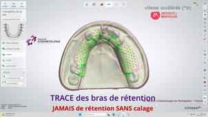 2026_3ShapeDM2025_conception mandibulaire intégrale_vitessepar8.mp4