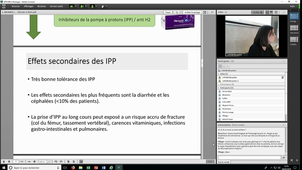 DU_PEC_Obesite_28022019_Meunier_Complications_digestives