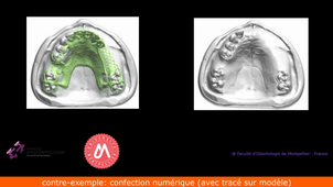 2025_DFASO2_problématique_accentuation des limites_plans de coupe.mp4