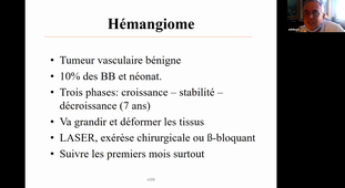 DU de chirurgie plastique pédiatrique Pr De Buys, anomalie de la lèvre et de la bouche  08/04/2021 10h30 à 11h30