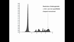 DFASM2 MIF 03/02/2021	10:00	12:00	Connaître la démarche diagnostique en présence d'une gammapathie monoclonale	LOZANO C. - RIVIERE S.	salle 307